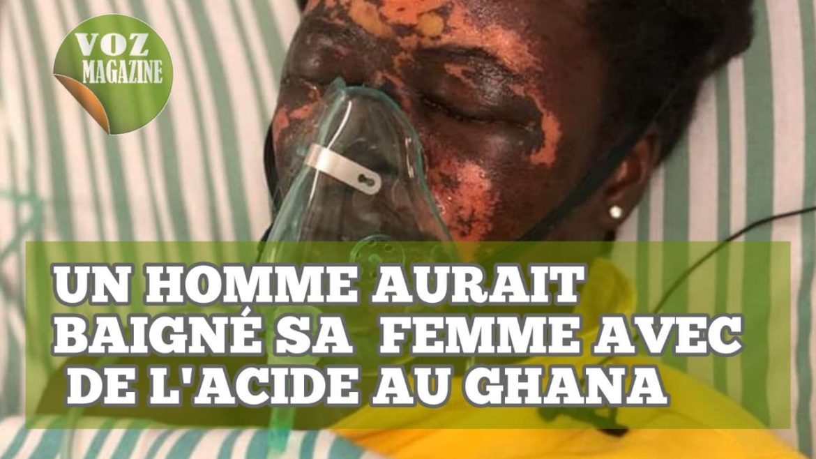 Ghana : Un homme aurait baigné sa femme avec de l’acide